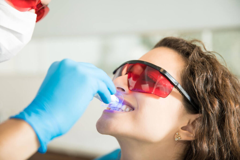 Um dentista de luvas azuis utiliza uma luz de polimerização azul sobre a arcada dentária superior de uma paciente de cabelos cacheados. Ambos estão usando óculos de proteção vermelhos em procedimento de clareamento dental