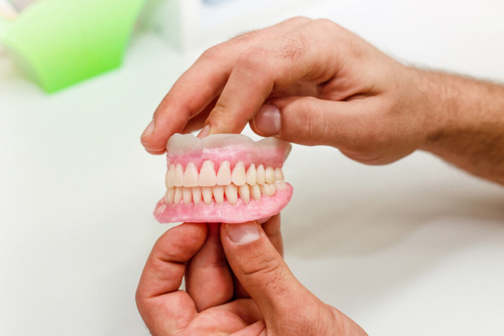Mãos segurando modelo de prótese dentária. Solução para dentadura superior frouxa com prótese protocolo na Estrada de Itapecerica