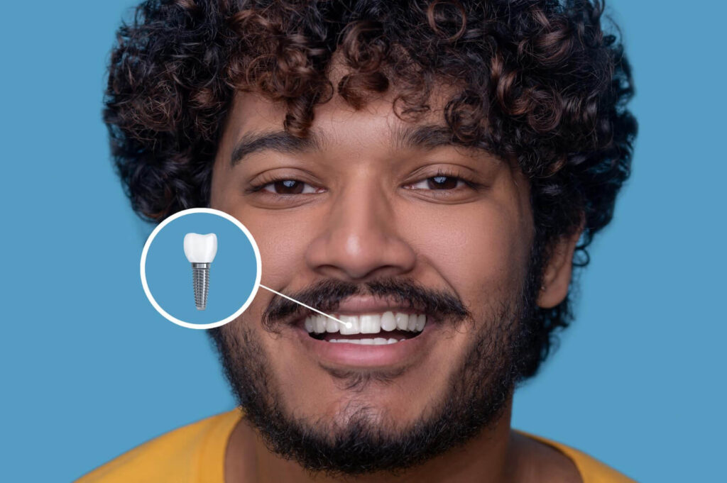 Homem de cabelo cacheado sorrindo em fundo azul. Gráfico destaca implantes dentários na Estrada de Itapecerica no Instituto do Sorriso.