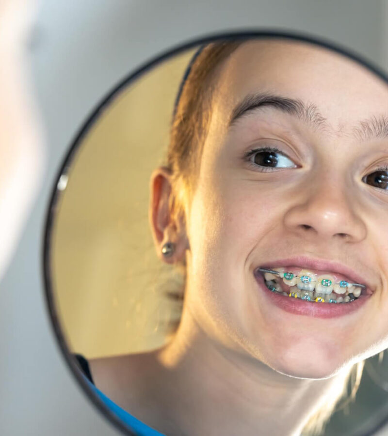 Aparelho Convencional